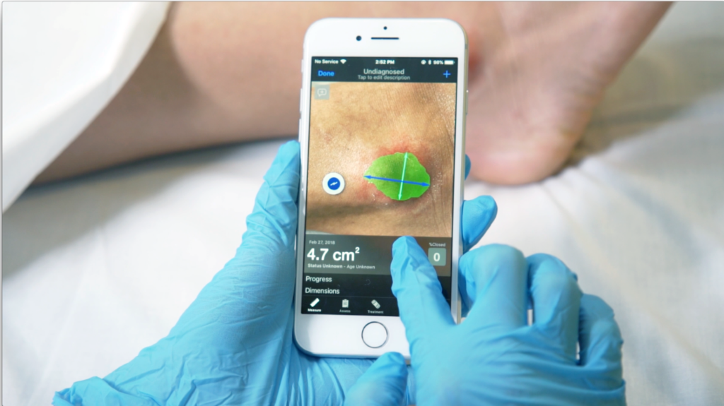 Swift Medical wins Gold for use of AI in wound care